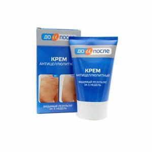 Krém a narancsbőr ellen és a sejtek vérkeringésének kezelésére - ELŐTTE ÉS UTÁNA-100ml