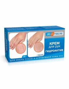 Hidroaktív kézkrém - erősen kiszáradt kézbőrre - ELŐTTE ÉS UTÁNA - 100ml